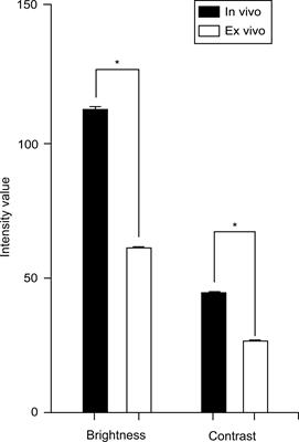 Characterization of ex vivo and in vivo intraoperative neurosurgical confocal laser endomicroscopy imaging